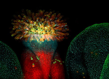 BioScapes-Olympus-International-Digital-Imaging-Competition-08