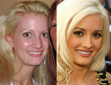 holly-madison-before-after-prima-dopo-rifatta
