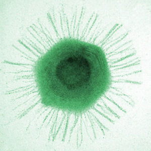 mimivirus-anello-congiunzione-tra-virus-e-batteri