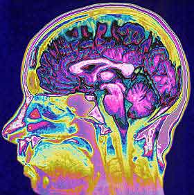 cellule-cervello-connessioni-mielina-Neurobiology-of-aging-neuroni-sport.jpg