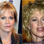 melanie-griffith-prima-dopo-before-after